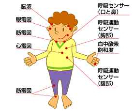 PSGの装着場所